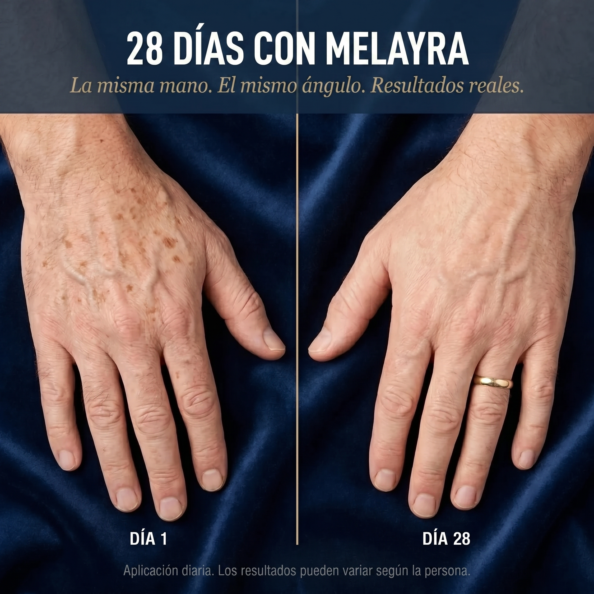 Melayra - Crema Antimanchas™